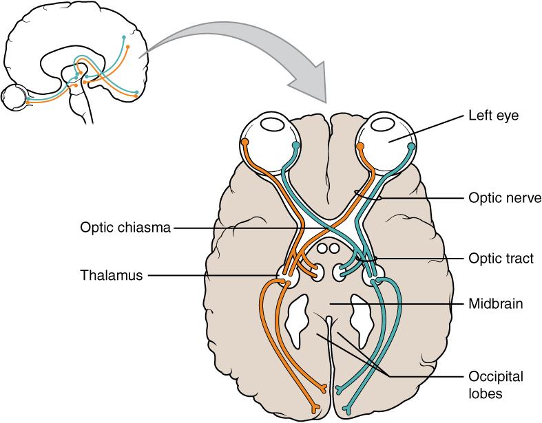 This illustration shows a superior view of a cross section of the brain. The anterior side of the brain is at the top of the diagram with the two eyes clearly visible. Each eye contains a left nerve tract and a right nerve tract. In the left eye, the left nerve tract travels straight back to the right side of the thalamus. It then enters the left occipital lobe. Conversely, the right nerve tract crosses to the right side of the brain through the optic chiasma. It travels through the right side of the thalamus and enters the right occipital lobe. In the right eye, the opposite is true. The left nerve tract crosses over to the left side of the brain at the optic chiasma, traveling into the left side of the thalamus and the left side of the occipital lobe. However, the right nerve tract leads straight back to the right side of the thalamus and the right occipital lobe. Therefore, the optic chiasma is where the right nerve tract from the right eye crosses over the left nerve tract from the left eye.