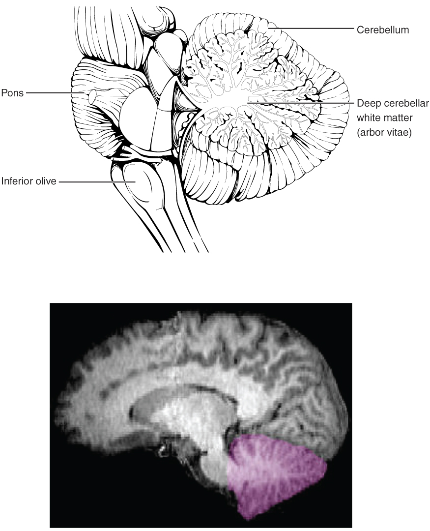This figure shows the location of the cerebellum in the brain. In the top panel, a lateral view labels the location of the cerebellum and the deep cerebellar white matter. In the bottom panel, a photograph of a brain, with the cerebellum in pink is shown.