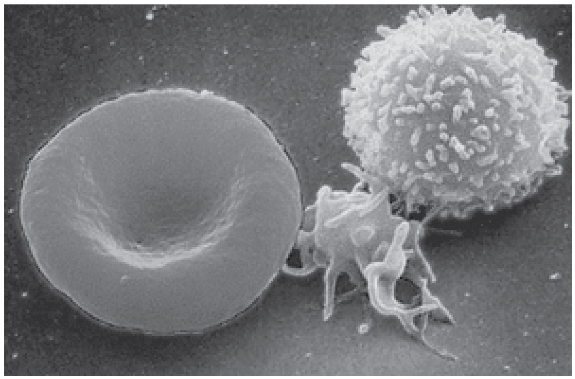 This photo shows a red blood cell and a white blood cell.