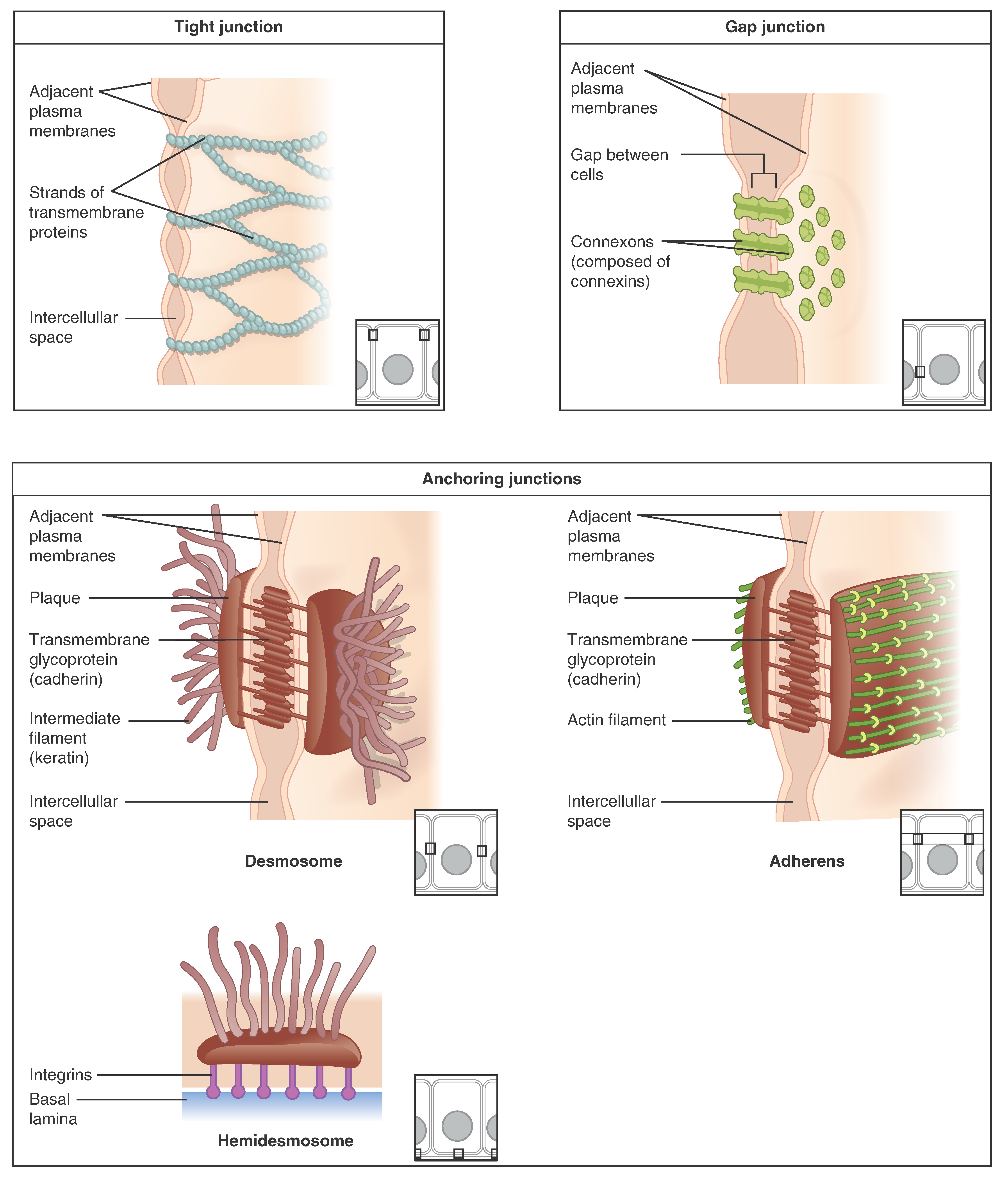These three illustrations each show the edges of two vertical cell membranes. The cell membranes are viewed partially from the side so that the inside edge of the right cell membrane is visible. The upper left image shows a tight junction. The two cell membranes are bound by transmembrane protein strands. The proteins travel the inside edge of the right cell membrane and cross over to the left cell membrane, cinching the two membranes together. The cell membranes are still somewhat separated in between neighboring strands, creating intercellular spaces. The upper right diagram shows a gap junction. The gap junctions are composed of two interlocking connexins, which are round, hollow tubes that extend through the cell membranes. Two connexins, one from the left cell membrane and the other from the right cell membrane, meet between the two cells, forming a connexon. Even at the site of the connexon, there is a small gap between the cell membranes. On the inside edge of the right cell membrane, the gap junction appears as a depression. Three connexins are embedded into the membranes like buttons on a shirt. The bottom images show the three types of anchoring junctions. The left image shows a desmosome. Here, the inside edge of both the right and left cell membranes have brown, round plaques. Each plaque has tentacle-like intermediate filaments (keratin) that extend into each cell’s cytoplasm. The two plaques are connected across the intercellular space by several interlocking transmembrane glycoproteins (cadherin). The connected glycoproteins look similar to a zipped-up zipper between the right and left cell membranes. The right image shows an adheren. These are similar to desmosomes, with two plaques on the inside edge of each cell membrane connected across the intercellular space by glycoproteins. However, the plaques do not contain the tentacle-like intermediate filaments branching into the cytoplasm. Instead, the plaques are ribbed with green actin filaments. The filaments are neatly arranged in parallel, horizontal strands on the surface of the plaque facing the cytoplasm. The bottom image shows a hemidesmosome. Rather than located between two neighboring cells, the hemidesmosome is located between the bottom of a cell and the basement membrane. A hemidesmosome contains a single plaque on the inside edge of the cell membrane. Like the desmosome, intermediate filaments project from the plaque into the cytoplasm. The opposite side of the plaque has purple, knob-shaped integrins extending out to the basal lamina of the basement membrane.