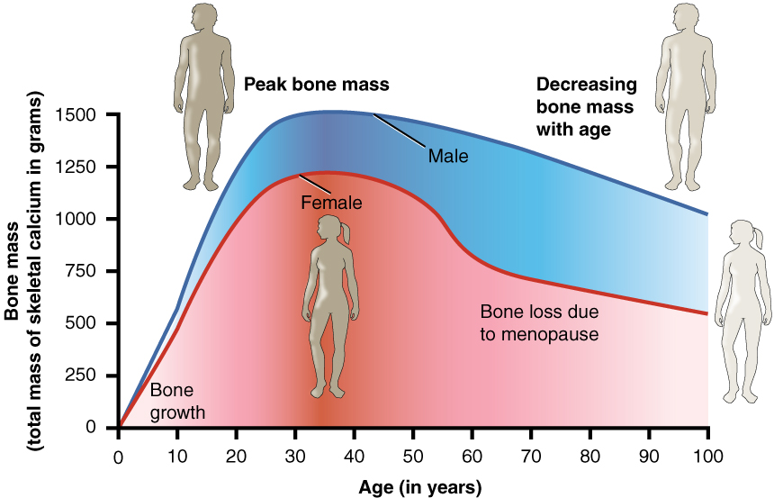 This graph shows bone mass (total mass of skeletal calcium in grams) on the Y axis. The Y axis scale goes from 0 up to 1500. The x axis displays age in years from 0 to 100 years. Two plot lines are shown: a blue line for males and a pink line for females. Male bone mass climbs rapidly from 0 grams to 1500 grams between age 0 and age 25. Bone mass then slowly drops to 1000 grams between age 25 and age 100. Female bone loss climbs rapidly from 0 grams to about 1200 grams between age 0 and age 28. Female bone mass then drops very slowly from 1200 grams to 1000 grams between age 29 and age 55. Bone mass then drops steeply from 1000 grams to 750 grams between ages 55 and 60. This is labeled on the graph as bone loss due to menopause. After this steep drop, the female line again levels somewhat, but still drops gradually, much like that of the male. Between age 60 and age 100, female bone density drops from 750 grams to about 625 grams.