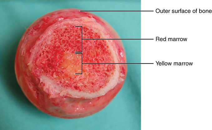 This photo shows the head of the femur detached from the rest of the bone. The compact bone at the surface of the head has been removed to show the spongy bone beneath. Rather than being solid, like the compact bone, the spongy bone is mesh like with many open spaces, giving it the appearance of a sponge. A circle of yellow marrow is located at the exact center of the spongy bone. The red marrow surrounds the yellow marrow, occupying most of the interior space of the head.