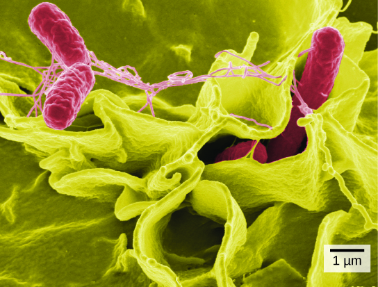 Part b: In this scanning electron micrograph, bacteria appear as three-dimensional ovals. The human cells are much larger with a complex, folded appearance. Some of the bacteria lie on the surface of the human cells, and some are squeezed between them.