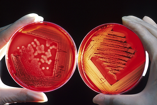 Two bacterial plates with red agar are shown. Both plates are covered with bacterial colonies. On the right plate, which contains hemolytic bacteria, the red agar has turned clear where bacteria are growing. On the left plate, which contains non-hemolytic bacteria, the agar is not clear.