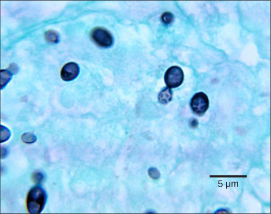 Micrograph shows budding yeast cells. The parent cells are stained dark blue and round, with smaller, teardrop shaped cells budding from them. The cells are about 2 microns across and 3 microns long.