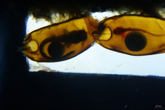 The photo shows long, thin shark embryos encase in egg cases.