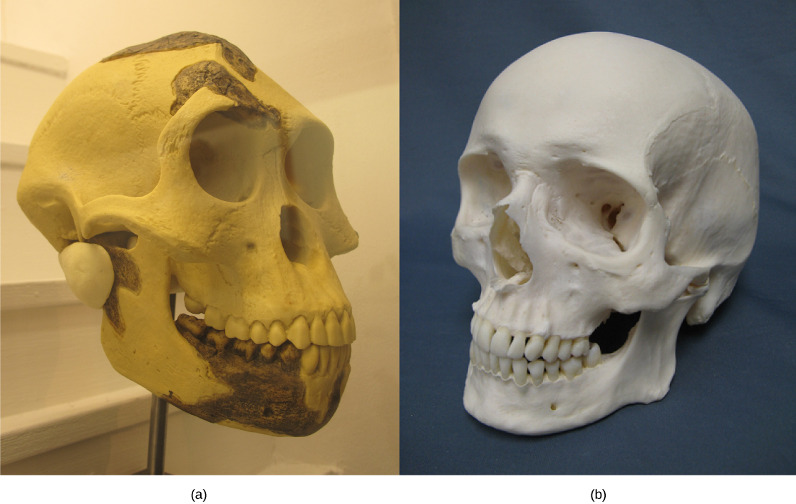 Photo A shows an A. afarensis skull, which is similar in shape but the forehead slopes back and the jaw juts out. Photo A shows a human skull.