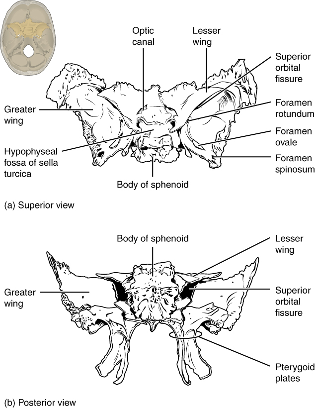 This image shows the location and structure of the sphenoid bone. A small image of the skull on the top left shows the sphenoid bone highlighted in ochre yellow. The top panel shows the superior view of the sphenoid bone and the bottom panel shows the posterior view of the sphenoid bone.