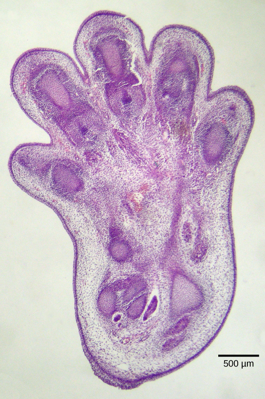 This photo shows a histological section of a foot of a 15-day-old mouse embryo. Tissue connects the space between the toes.