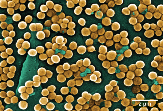 The micrograph shows clusters of round bacteria clinging to a surface. Each bacterium is about 0.4 microns across.