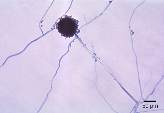 Micrograph shows Aspergillus mycelia, which look like long threads, and a spherical conidiophore about 40 microns across.