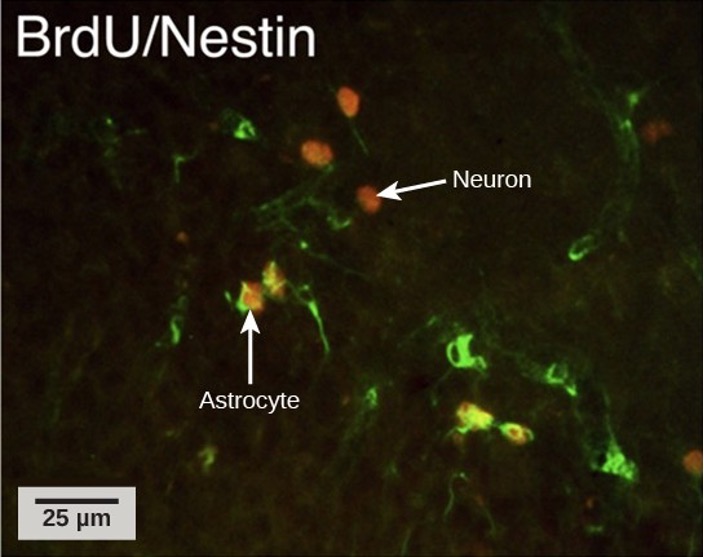 Neurons under a microscope glowing with activity.