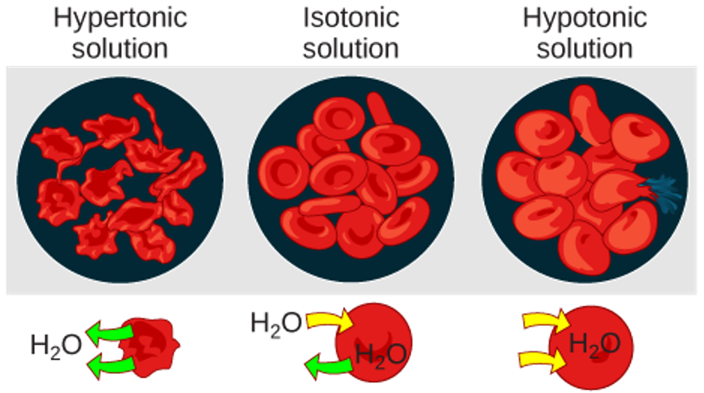 Illustration of red blood cells in hypotonic, isotonic, and hypertonic solutions. In the hypertonic solution, the cells shrivel and take on a spiky appearance. In the isotonic solution, the cells are normal in appearance. In the hypotonic solution, the cells swell and one has ruptured.