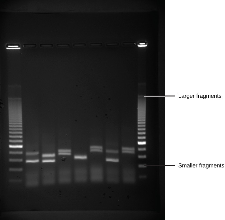 Image of a gel showing DNA fragments in bands under UV light.