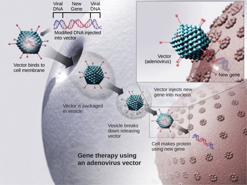 Diagram of the steps of gene therapy including: vector binds to cell membrane, then vector is packaged in a vesicle, then the vesicle breaks down releasing the vector into the cell, then the vector binds to the nucleus and injects the new gene into the nucleus, then the cell makes proteins using the new gene.