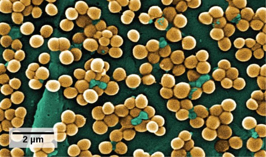 Image of Staphylococcus aureus bacteria under the microscope.