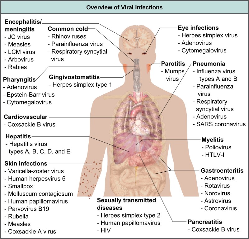 Overview of viral infections in various parts of the human body.