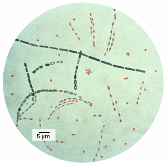 Image of bacteria under a microscope.