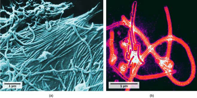 Scanning electron micrograph and transmission electron micrograph of the ebola virus.