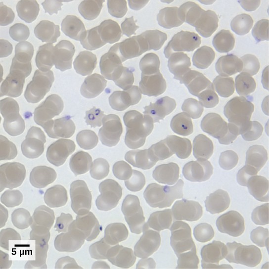 Image of blood cells infected with purple dots of P. faciparum under the microscope.