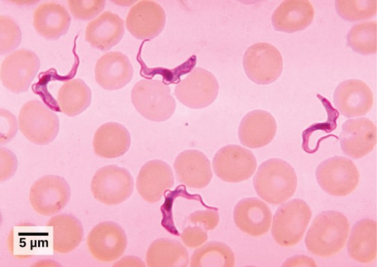 Figure of Trypanosomes and red blood cell undert he microscope.