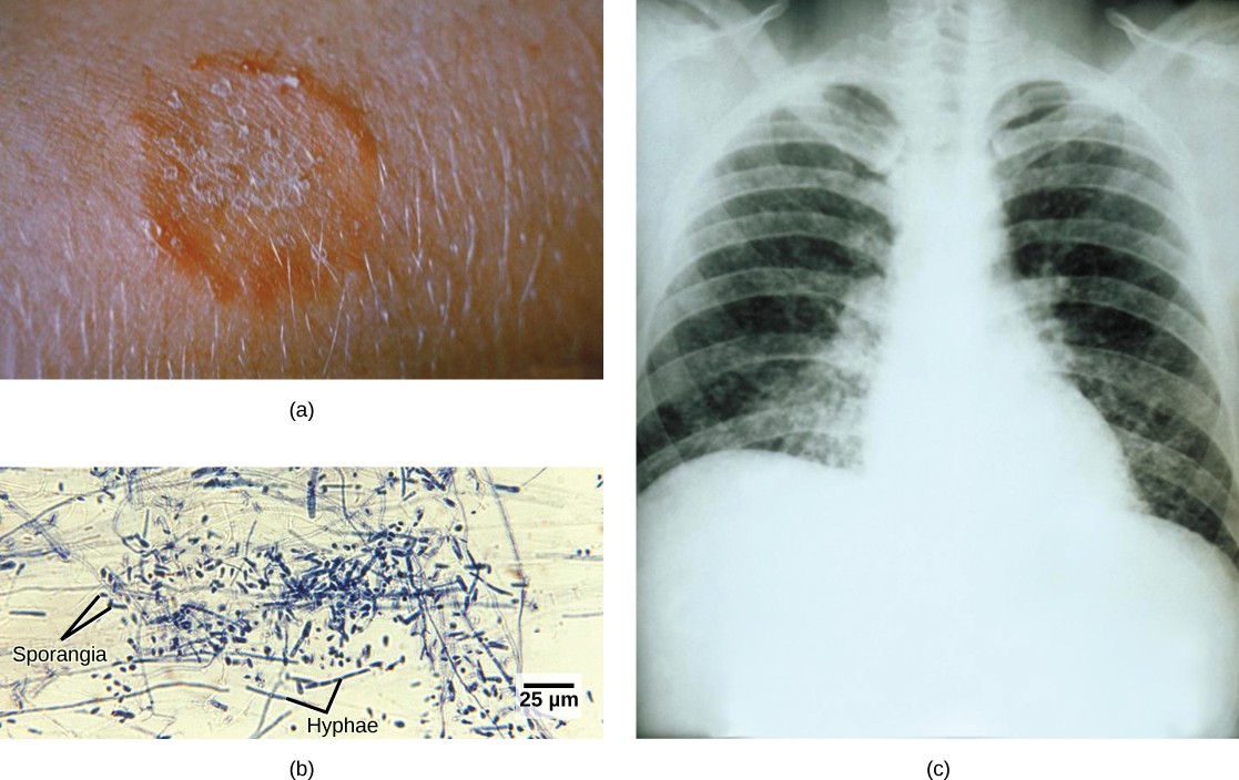 Three images of the fungal pathogens described in the caption.