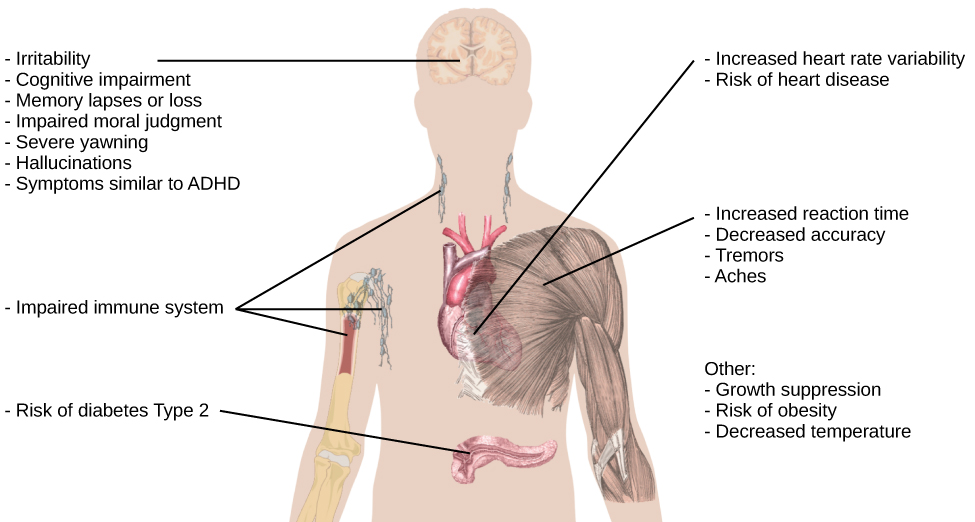 An illustration of the top half of a human body identifies the locations in the body that correspond with various adverse affects of sleep deprivation. The brain is labeled with Irritability,” “Cognitive impairment,” “Memory lapses or loss,” “Impaired moral judgement,” “Severe yawning,” “Hallucinations,” and “Symptoms similar to ADHD.” The heart is labeled with Increased heart rate variability and Risk of heart disease. The muscles are labeled with Increased reaction time, Decreased accuracy, Tremors, and Aches. There is an organ near the stomach labeled Risk of diabetes Type 2. Other risks include Growth suppression, Risk of obesity, Decreased temperature, and Impaired immune system.