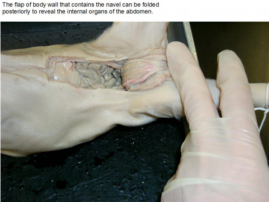 Abdominal flap pulled back. Opened abdominal cavity.