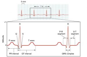 Electrocardiogram with waves labeled.