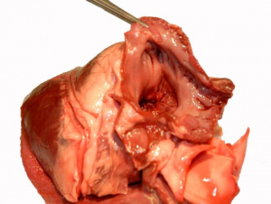 Left atrium.