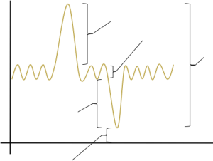 Lung volumes and capacities with spaces for labeling.