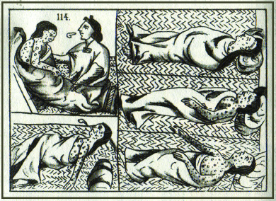 A drawing shows five depictions of an Aztec smallpox victim. The victim, who is covered with spots, is shown sleeping, vomiting, and being examined by a healer.